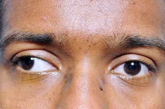 Best Eye Hospital in JP Nagar Bangalore Karnataka